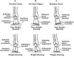 Ankle Conditions Flashcards Chiropractic Care Conditioner Foot Anatomy