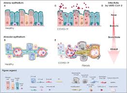 Learn my best techniques for the ielts test. Frontiers Human Based Advanced In Vitro Approaches To Investigate Lung Fibrosis And Pulmonary Effects Of Covid 19 Medicine