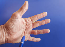 Hierbei wird mit einer sterilen kanüle, durch feine drehbewegungen mit dem finger, ein loch in den nagel gebohrt. Geplatzte Ader Ursachen Und Behandlung Geplatzter Aderchen Heilpraxis