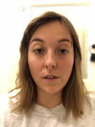 If you're wondering if your face is symmetrical, the best way to test it is by printing out of a photo of your face. Asymmetrical Face Progressing With Age Photo