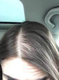 The longer thin, fine hair gets, the flatter it lays. Thin Hair Help Hair