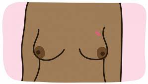 She had a lumpectomy, but then they had to take off around 390 men are diagnosed with breast cancer each year in the uk, while 55,000 women are diagnosed with the disease. Breast Cancer Symptoms Breast Cancer Now