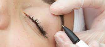 8 final words on galvanic electrolysis for hair removal this ​is an example of an electrolysis method whereby chemical reaction is used to destroy the hair follicle such that a direct electrical current is used. Electrolysis Hair Removal Wimbledon Kensington London