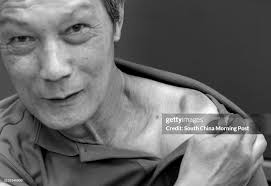 Yip Pak-ling shows the dark callus