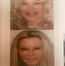 Michelle Huseman RN (@michellehuseman_aestheticsrn) • Instagram photos and  videos