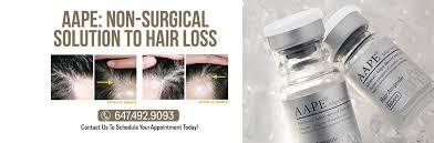 Although there can be many causes of hair loss, the majority of hair loss in both men and women is caused by genetics, and is known as androgenetic alopecia. Aape Stem Cell Hair Loss Therapy Trichology Centre Toronto