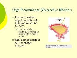 Une forme sensorielle et une forme motrice. Conseils Pour Gerer L Incontinence Par Imperiosite Et La Vessie Hyperactive Incontinence Hyperactive Vessie 2021