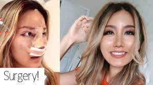 The local team provides all kinds of plastic surgery and aesthetic procedures. I Got Plastic Surgery In Korea Id Hospital Part 1 Youtube