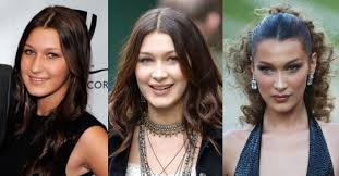 This idea has been the official practice of the american society of. Bella Hadid S Before After Surgery Evolution Elle Australia