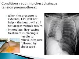 The condition can arise if the chest wall is injured, opened, or if any tear or rupture happens in the pulmonary tissue. How Are Punctured Lungs Diagnosed Quora