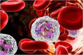 Drugs Targeting Neutrophils Could Reduce Ards In Severe Covid 19