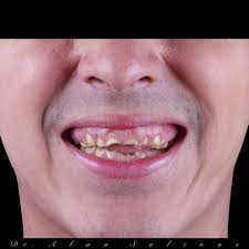 Alan Salinas Odontologia