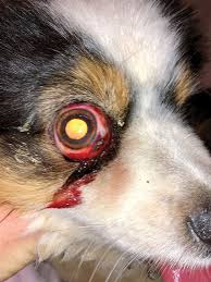 Image result for Proptosis