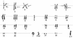 Das königliche traumpaar des 19. Erbgange Chromosomen Blutgruppen Humangenetik