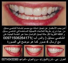 مفاجأة طبيب تجميل أسنان المشاهير أنشاصي سمايل By Whatsapp