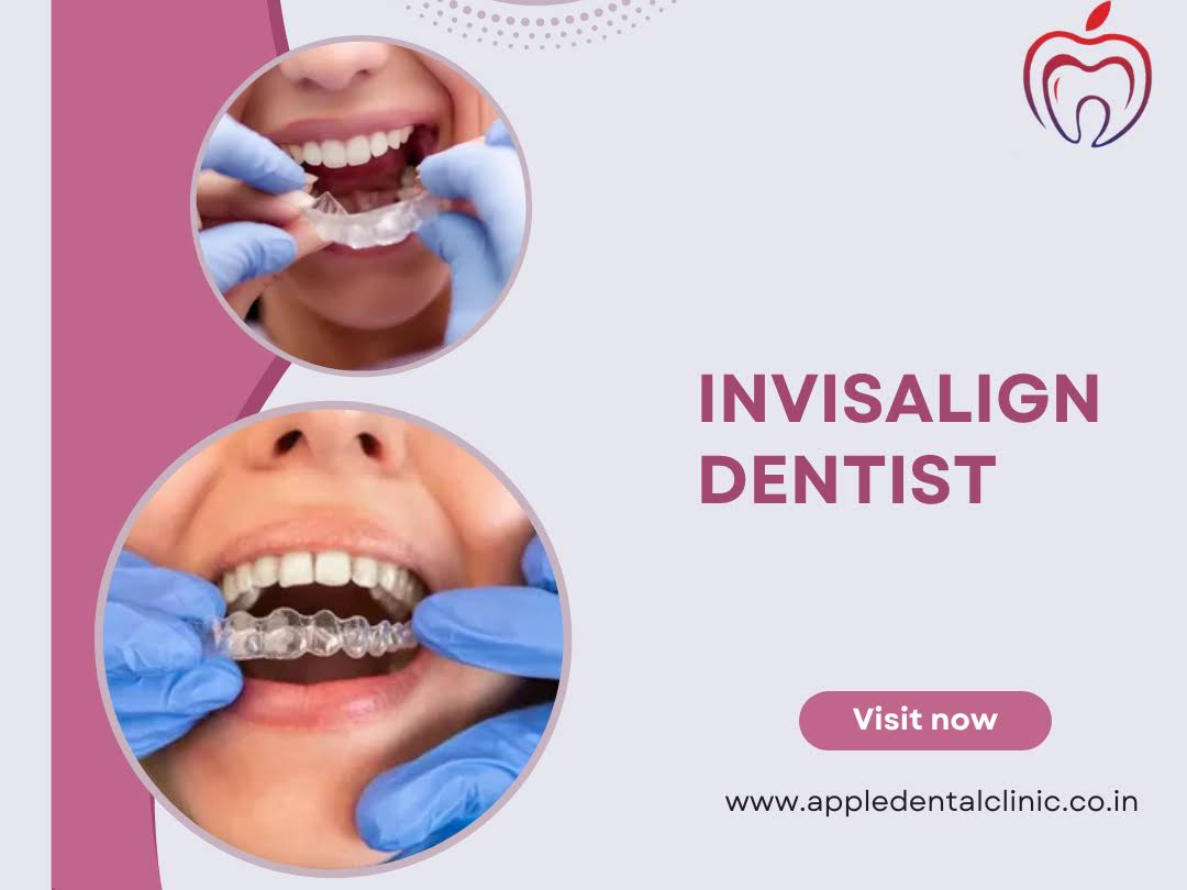 Invisalign Dentist Near Me product image