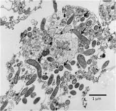 Image result for Rickettsiae