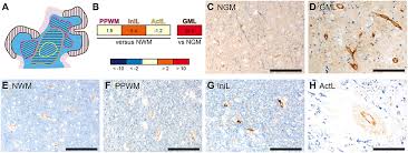 We would like to show you a description here but the site won't allow us. Frontiers Pecam 1 Stabilizes Blood Brain Barrier Integrity And Favors Paracellular T Cell Diapedesis Across The Blood Brain Barrier During Neuroinflammation Immunology