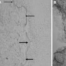 Image result for Uapaca nitida