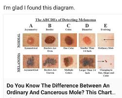 Mole Id One Color Mole Color