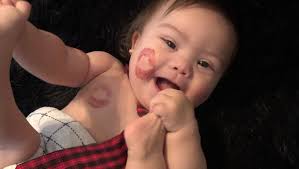 Fundraiser by Kalen Orr : Help the Clifton's cover X's medical bills