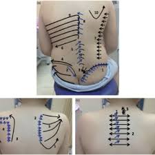 The human back, also called the dorsum, is the large posterior area of the human body, rising from the top of the buttocks to the back of the neck. All Connective Tissue Areas In The Back Sacral Lumbar Lower Download Scientific Diagram