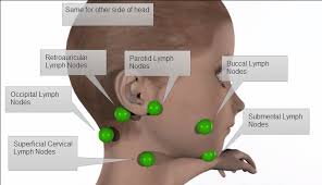 Basal cell cancers rarely metastasize to lymph nodes, but they can grow quite large and invade local structures. Sometimes People Who Experience Swollen Lymph Nodes In Neck Is Difficult To Swallow They Also Feel Fullness In T Swollen Lymph Nodes Lymph Nodes Lymph Glands