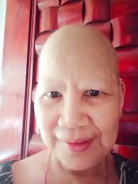 Let's welcome our new members! Dr Kennedy , Elvir Aljicevic, Alison  Benedict, Jennifer Sanchez, Lisa Coffey, Kate Singh, Magdalena Valentino,  Mãrvín Bõy, Chris Brown, Clinicana Hair Transplant, Mike Vansharvski, D  John Kennedy,