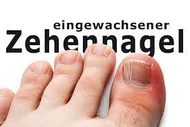 Was Tun Bei Einem Eingewachsenen Zehennagel Gesund Co At