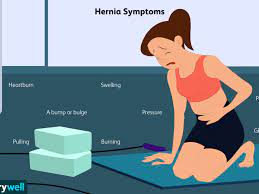 Hernia: Types, Symptoms, Causes, Diagnosis, Treatment