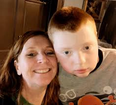 This child, with an extra chromosome, is valuable and worthy of life. Do  you agree?