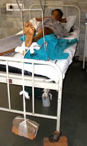 A hip fracture means a fracture of the proximal femur (proximal to 5 cm below the lesser trochanter). Https Www Rescue Essentials Com Femoral Traction Evolution Engineering And Systems