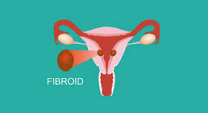The following foods should be included in your diet to keep them at bay Fibroids Liver Doctor