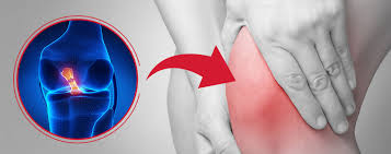 We did not find results for: Anterior Cruciate Ligament Injury Acl