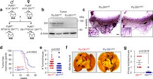 9 you're experiencing abnormal discharge. Dll1 Quiescent Tumor Stem Cells Drive Chemoresistance In Breast Cancer Through Nf Kb Survival Pathway Nature Communications