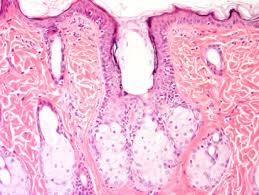 They do this by producing an oily substance called sebum. Sebaceous Gland An Overview Sciencedirect Topics