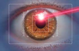 In an interview with iheartradio canada, the bad habits singer talks about not needing his signature glasses anymore after getting lasik eye. Is There An Age Limit For Lasik Surgery Assil Eye Institute