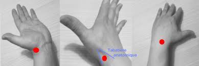 Douleurs osseuses, douleurs musculaires, ou douleurs tendineuses. Les Fractures Du Scaphoide Main Et Poignet