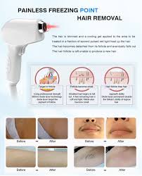 Perhaps knowing exactly how laser hair removal works might make it a bit less intimidating. Light See What S Behind