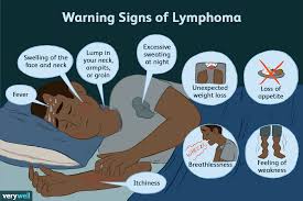 Sam delson, deputy director for external and legislative affairs at the california oehha. Lymphoma Signs Symptoms And Complications