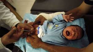 Image result for Neonatal Circumcision