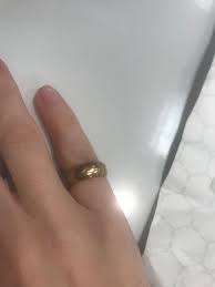 Plates, screws, and unremoved shrapnel from war wounds. Sterling Silver Ring Turned Gold Was Washing Dishes And 10 15 Minutes In My Ring Turned A Gold Color 3 Hours Later It Was Back To Silver Anyone Know What Happened Only Noteworthy