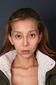 The term plastic surgery stems from the greek word plastikos, meaning to mold or to form. modern plastic surgery has evolved along two broad themes. Leng Yein Before Plastic Surgery
