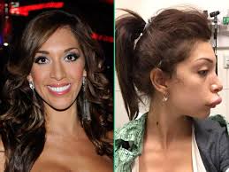 Farrah Abraham : la star de téléréalité défigurée par une injection ratée  dans les lèvres - Voici