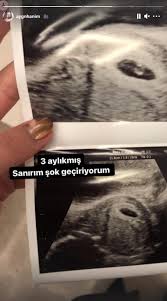 Hakan sabancı'nın eski sevgilisi aygün aydın instagram hesabından yaptığı açıklamalarla konuşuluyor. Hakan Sabanci Ile Adi Gecen Aygun Aydin Hamile Mi Aygun Aydin Kimdir Nereli Ve Kac Yasinda