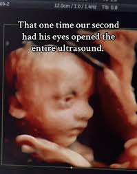 Storytime Videos Anna Jason and Chloe Ultrasound