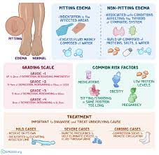 Pitting Edema What Is It Causes Grading Diagnosis Treatment And More Osmosis