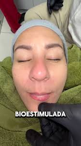 Te contamos un poco de este procedimiento., @lasercentergye