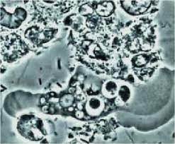 The jellylike protoplasm of the amoeba slowly moves in the. Magnification 1000x Typical Amoeba Surrounded By Neutrophils Bacilli Download Scientific Diagram