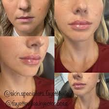 Deanna Holt CRNA DNP